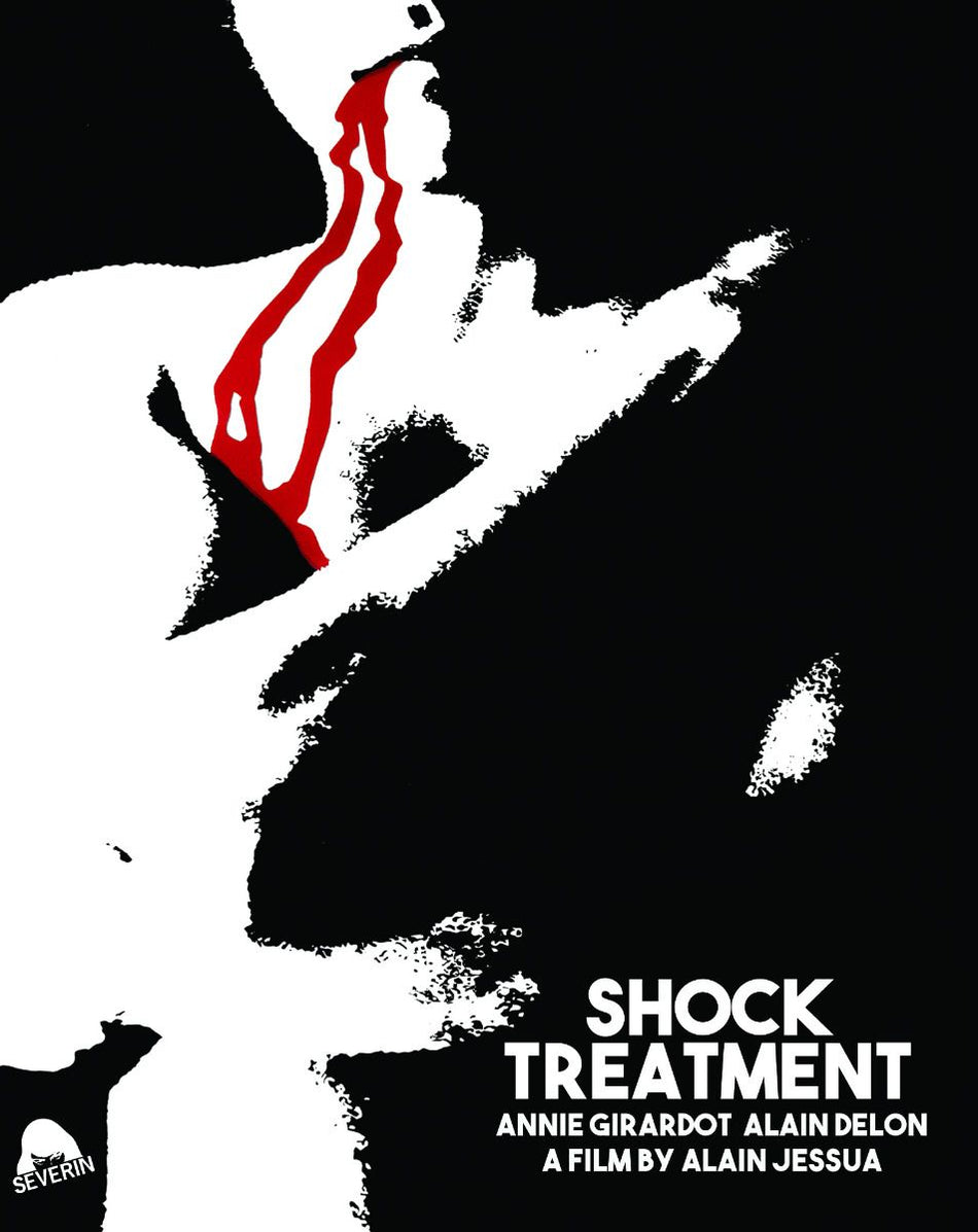 Shock Treatment (Limited Edition)