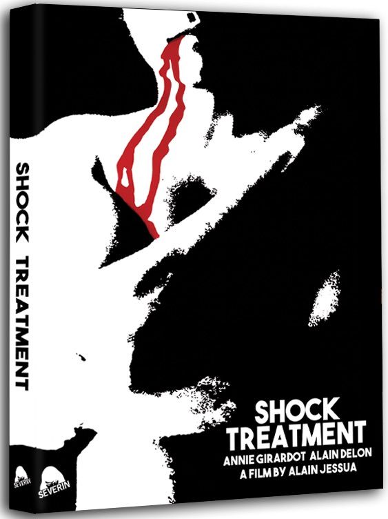 Shock Treatment